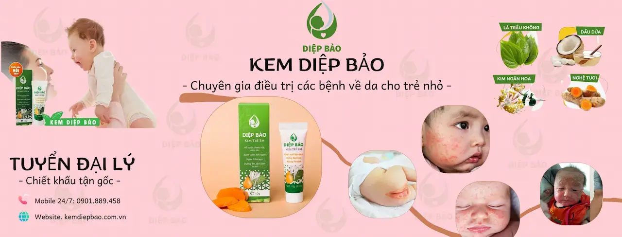 Kem Diệp Bảo Là 1 Thảo Dược Đông Y Gia Truyền Với Chất Lượng Tuyệt Vời Được Kiểm Chứng Bởi Hàng Triệu Bà Mẹ Tin Dùng Cho Trẻ Sơ Sinh & Trẻ Nhỏ.